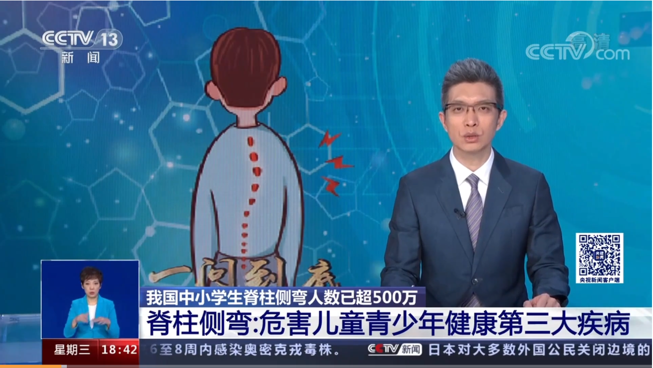 青少年脊柱側彎現(xiàn)狀堪憂