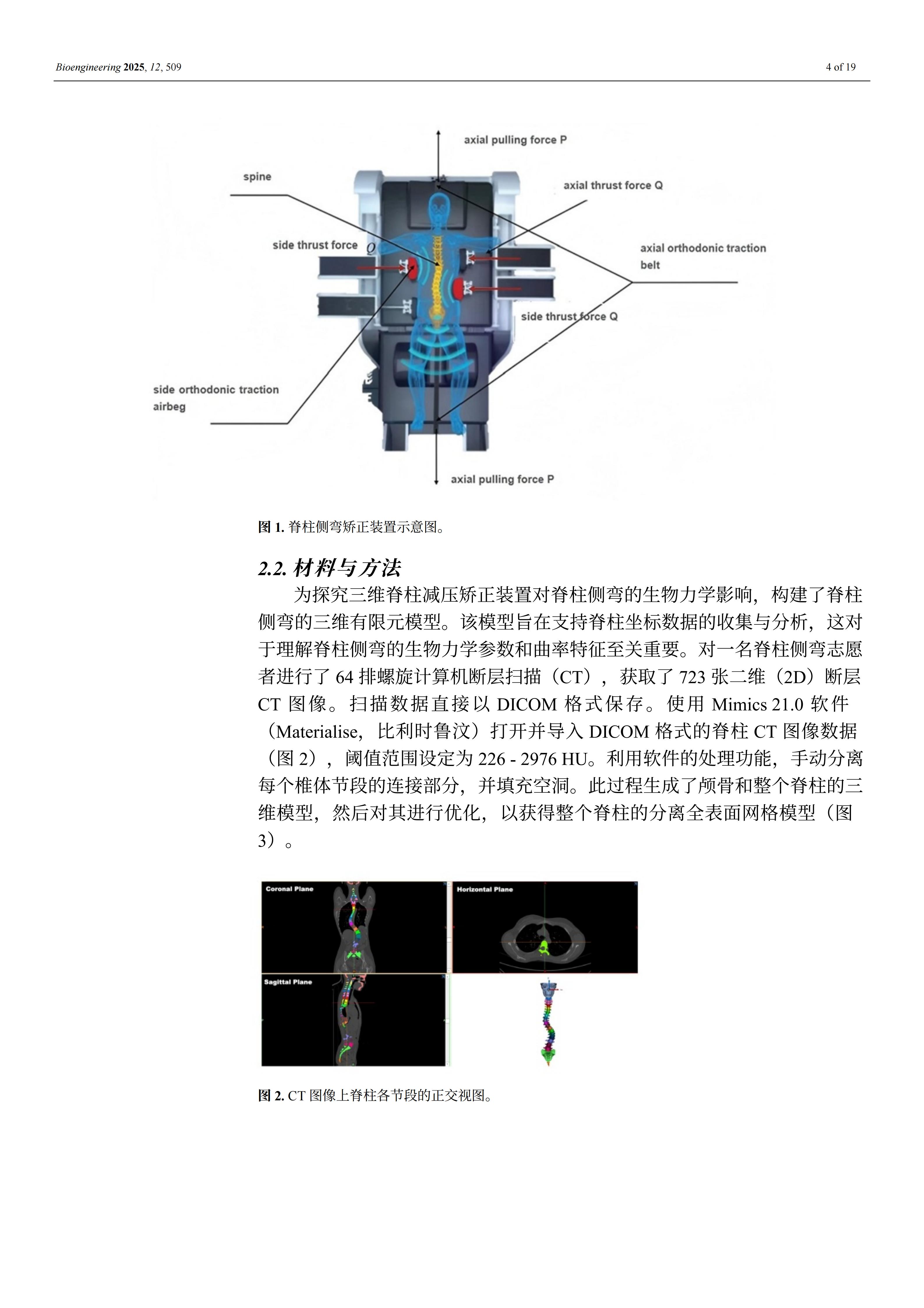 外星艙脊柱矯形裝置的效果